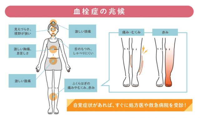 血栓症の兆候の写真