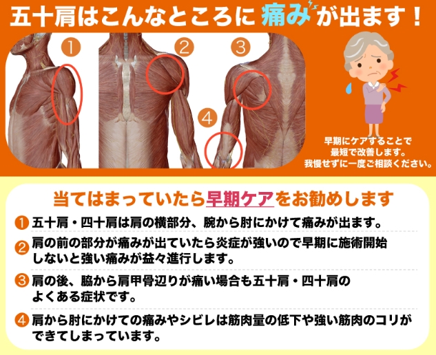 五十肩はこんなところに痛みが出ます!