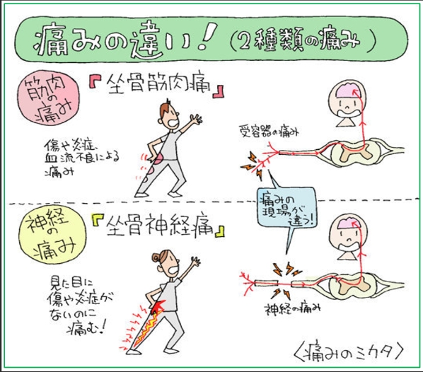 痛みの違い