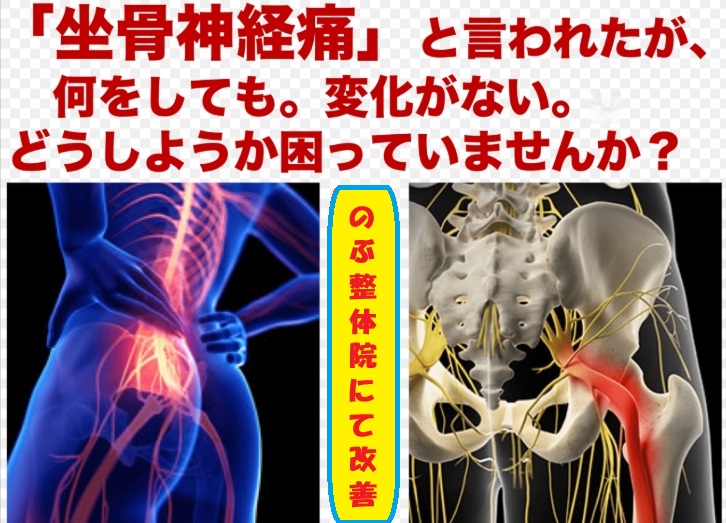 腰椎椎間板ヘルニアのメカニズム