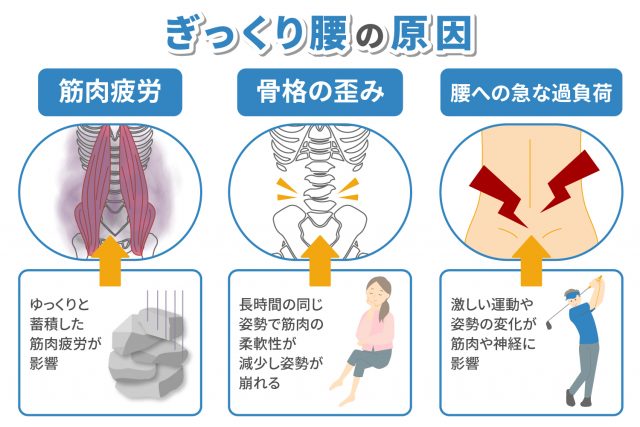 ぎっくり腰の原因