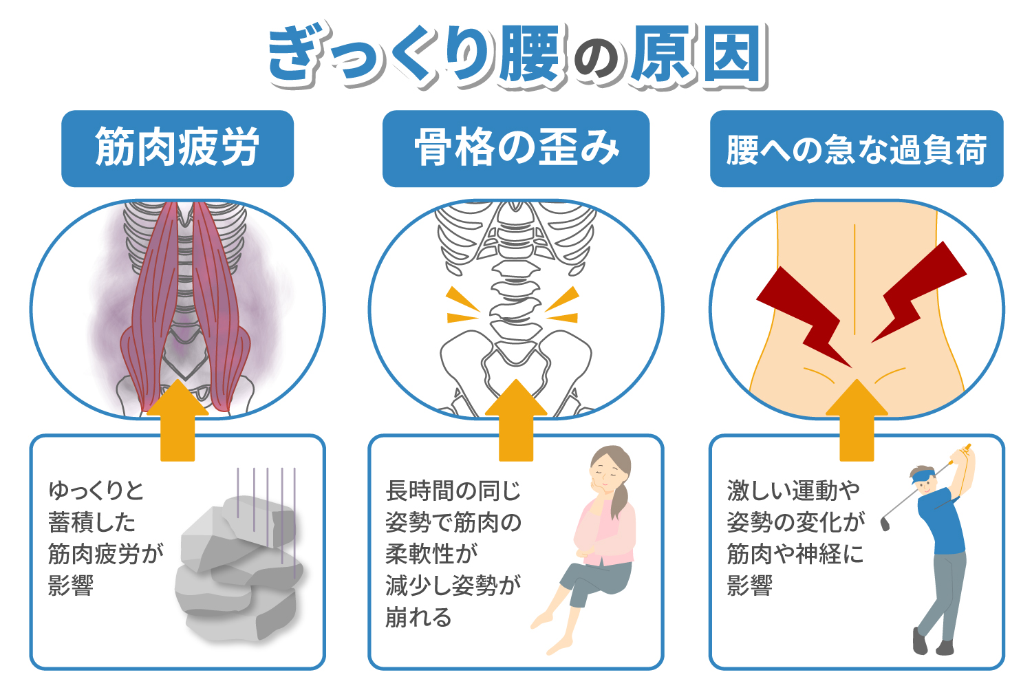 ぎっくり腰の原因