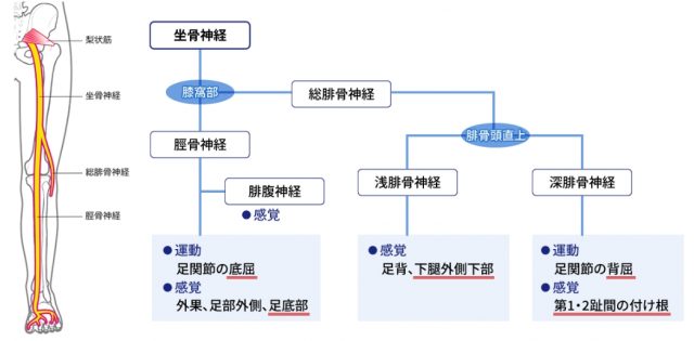 坐骨神経痛の原因は?歩けないほど痛くなることも!